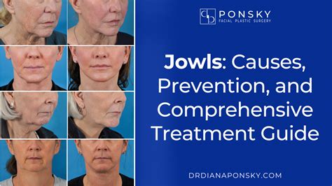 Jowls Causes Prevention And Comprehensive Treatment Guide