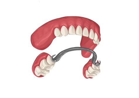 How Much Do Dentures Cost In 2024 Authority Dental