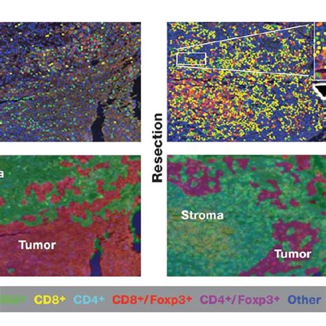 Multiplex Ihc Showing Relationships Of Immune Infiltrating Cells To