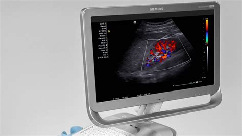 Acuson Nx2 Series Ultrasound System Siemens Healthineers Usa