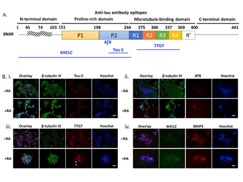 Tau Phospho Isoform Expression In Differentiated SH SY5Y Cells A