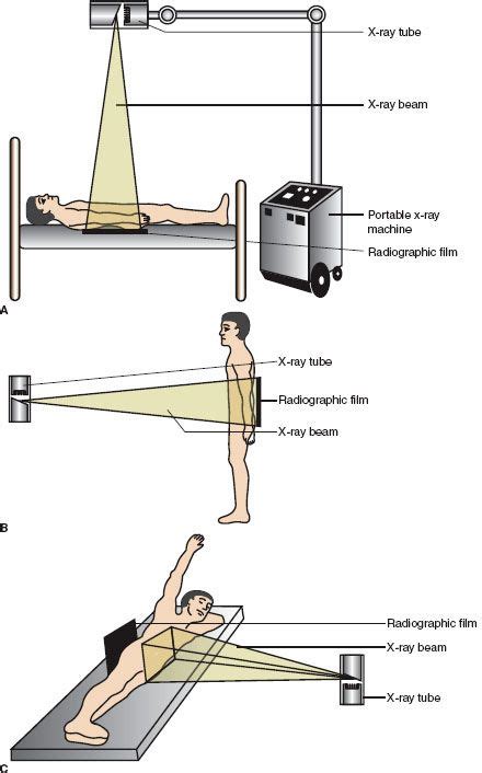 Abdomen X Ray Positioning