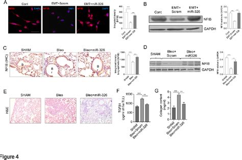 Figure 4 from MiR 326 mediated overexpression of NFIB offsets TGF β