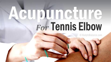 Acupuncture For Treating Golfers And Tennis Elbow Body In Balance