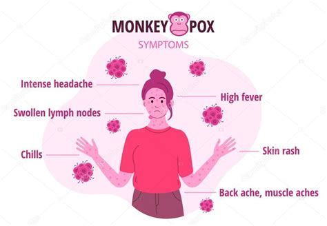 Brote De Viruela De Mono Infograf As De Los S Ntomas Del Virus En