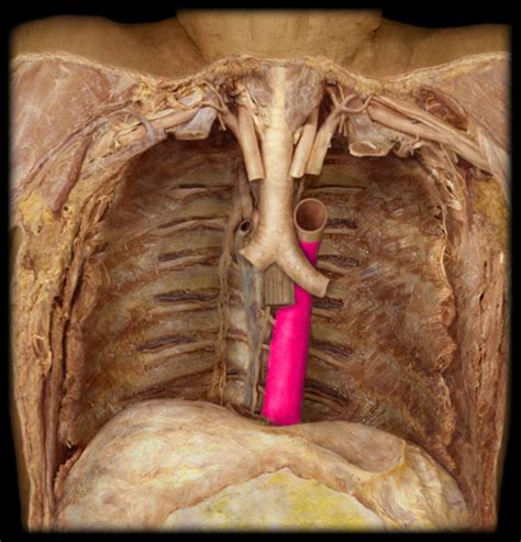 Bio 2300 Blood Vessels Of Thorax Abdomen And Pelvis Practical