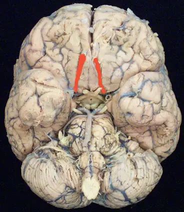 Nerfs crâniens Anatomie et troubles Explications Explications