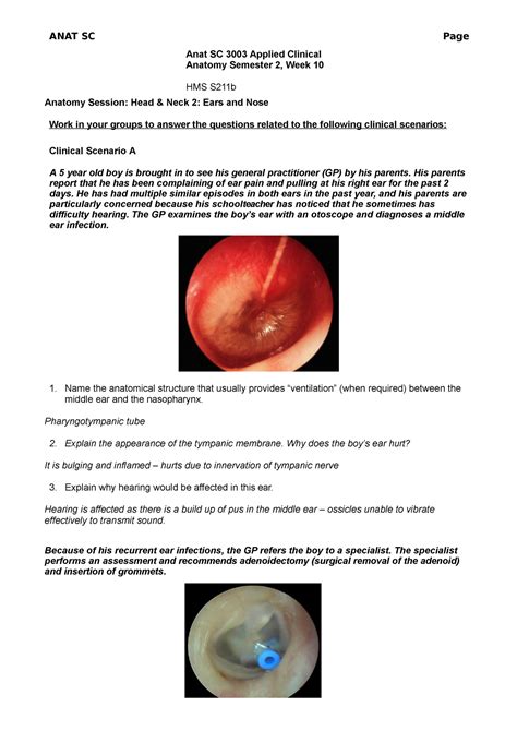 Week 10 Dry Lab Ears And Nose Anat Sc 3003 Applied Clinical Anatomy