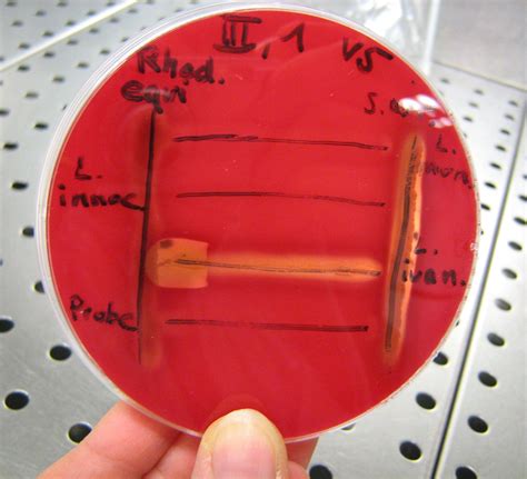 Listeria Monocytogenes