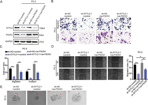 Overexpression Of Fscn Rescues The Function In Sytl Knockdown Cells