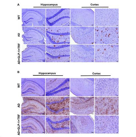 Role Of Glp And Trf On Induced Decrease In A Gfap And Iba