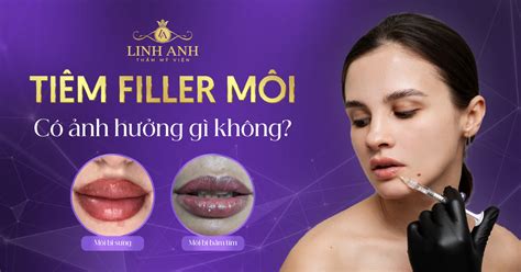 Tiêm filler môi có ảnh hưởng gì không Tác dụng phụ là gì