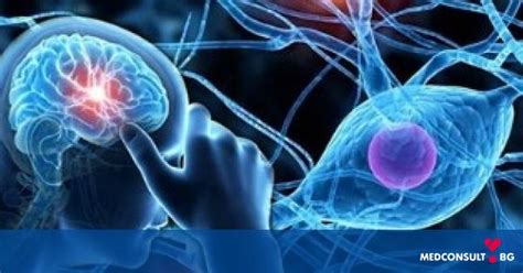 Кои са първите признаци при множествена склероза — Medconsult.bg