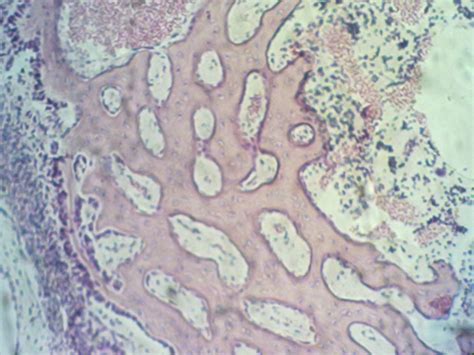 Spongy Bone Histology Howmed Images