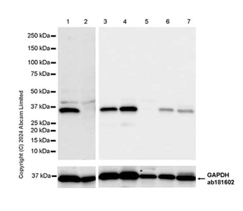 Anti Carbonic Anhydrase Ca Epr Ab