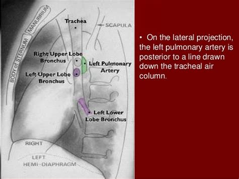 Chest X Ray