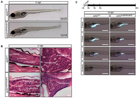 Epigenomes Free Full Text Genetic And Epigenetic Regulation Of