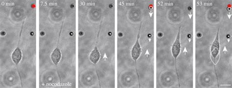 Disruption Of Microtubules By Nocodazole Facilitates Soma Translocation