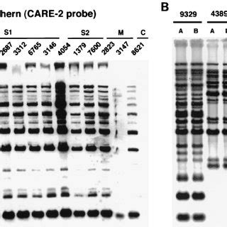 A Southern Hybridization Of Eco Ri Digested Genomic Dna Of Patients