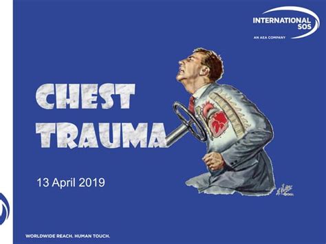 Chest Trauma Pedoman Trauma Tugas Belajar Ppt