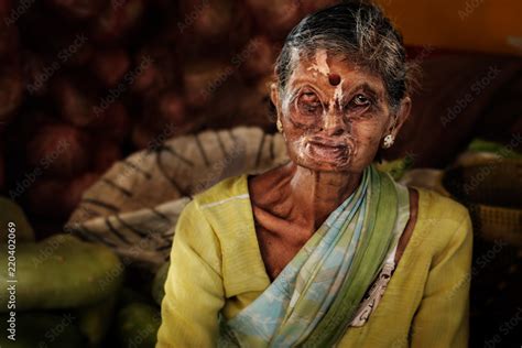 Portrait Of Elderly Indian Woman With Her Face Deformed And Scared After Acid Attack Scary