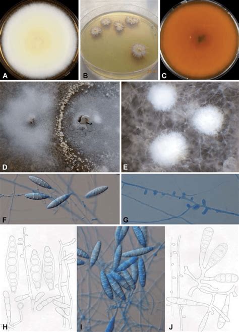 Microsporum Arthroderma Mirabile A C Colony Morphology Of Cbs