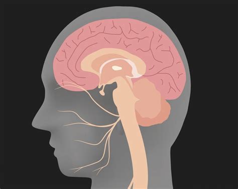 Hemifacial Spasm Types Symptoms And Causes Facial Nerve Brain Lesions Symptoms