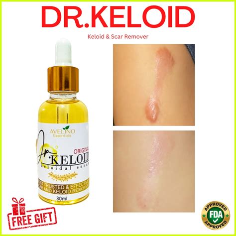 Dr Keloid Original Keloid Scar Remover 30ml Old Scar Keloid