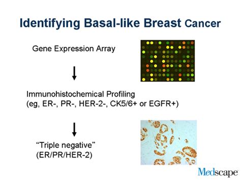 Triple Negative Breast Cancer Current Approaches New Frontiers