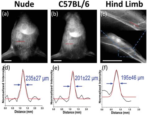 In Vivo Nirii Imaging For Evaluation Of Circulatory System A B In