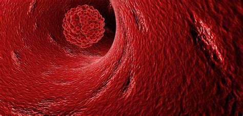 Blood Clots in Cancer Patients May be Caused by Chemotherapy, Study Says