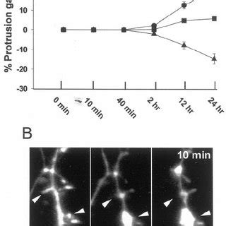 Protrusion Turnover And Nmda Induced Spine Loss Visualized With Yfp A