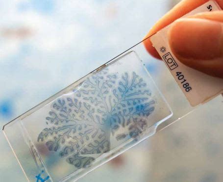 MND research goes global | Mirage News