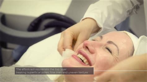 Laser Skin Rejuvenation With Cynosures Multiplex Affirm System At The