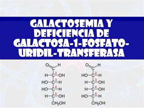 Galactosemia PPT