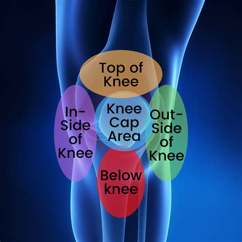 What Could Be Causing Your Knee Pain Dayton Orthopaedic Surgery