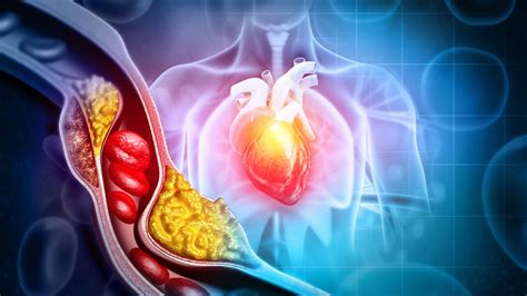 Cómo bajar el colesterol alto de forma natural y sin medicación