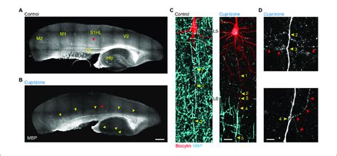 Demyelination Of The Main Axon Of Thick Tufted Layer Pyramidal