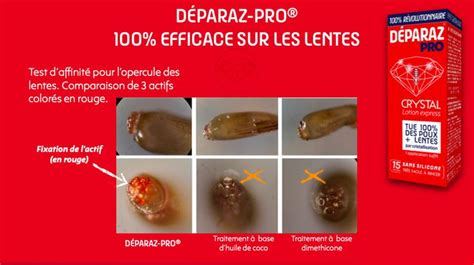 Deparaz Pro Efficace Sur Les Lentes