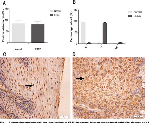 Figure 1 From Abnormal Localization And Tumor Suppressor Function Of