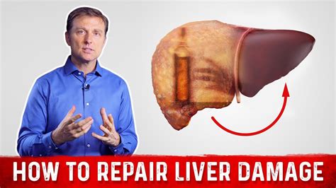 How To Repair Liver Damage After Alcohol Dr Berg On Liver Cirrhosis