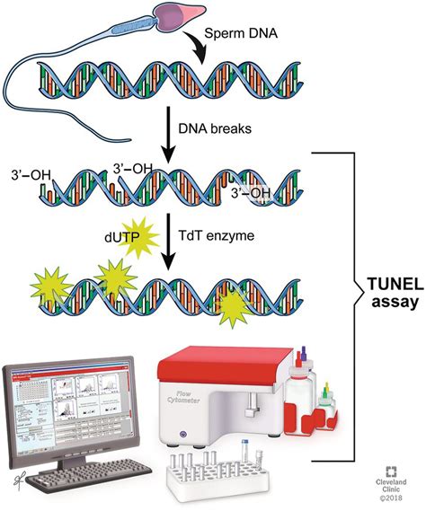 Chapter 19 Dna Damage Tdt Mediated Dutp Nick End Labelling Assay Basicmedical Key