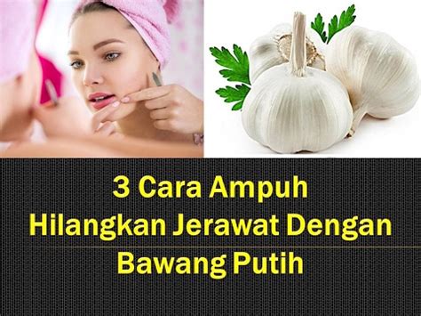 3 Cara Ampuh Hilangkan Jerawat Dengan Bawang Putih YouTube