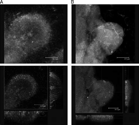 Confocal Laser Scanning Micrographs Illustrating The Changes In Biofilm