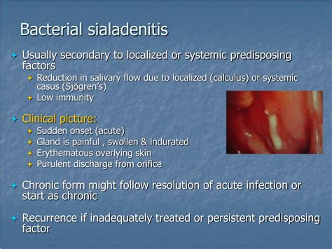 Ppt Salivary Gland Disease Powerpoint Presentation Free Download