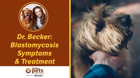 Dr. Becker: Blastomycosis Symptoms & Treatment - YouTube