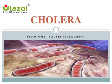 Cholera : Symptoms, causes and treatment