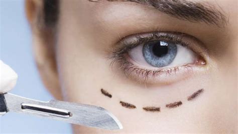 The Five Most Surprising Cosmetic Surgery Trends Across The Globe