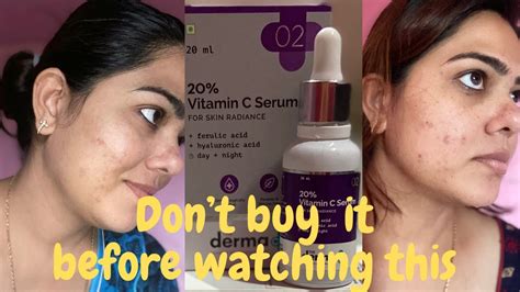 The Derma Co Vitamin C 20 Serum Full Honest Review Oily Acne Prone