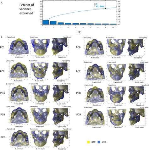 Morphologic Variations In The Craniofacial Structures In Japanese